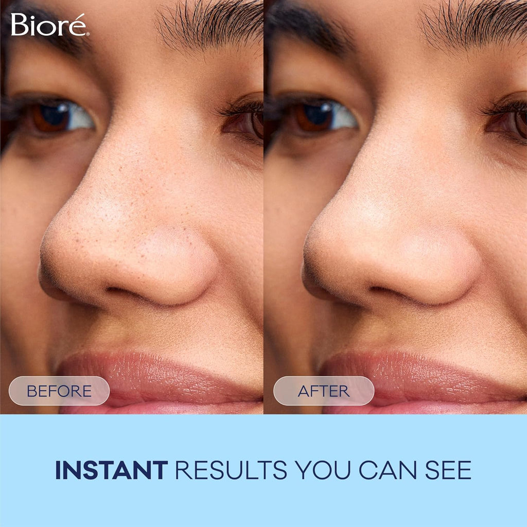 Clear Skin Solution™