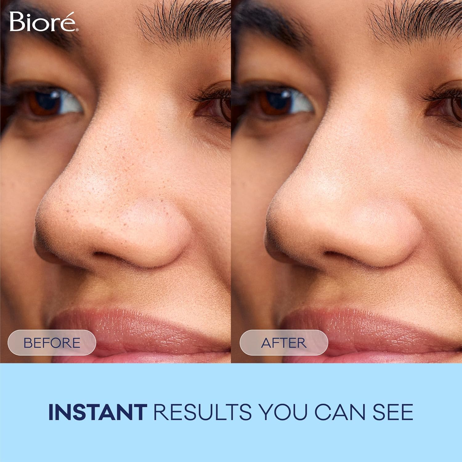 Clear Skin Solution™